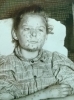 Black and white photograph of a juvenile female smallpox victim taken c.1900.