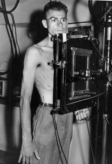 Black and white photograph of volunteer Jim Plaugher of Fresno, California, at an x-ray checkup, c.1944.